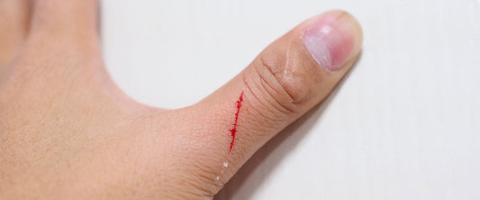 Dedo pulgar de la mano izquierda con una herida leve que se puede tratar con Vibac.