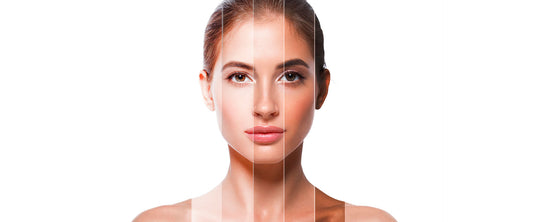 Mujer con varios tonos en la piel de su rostro.