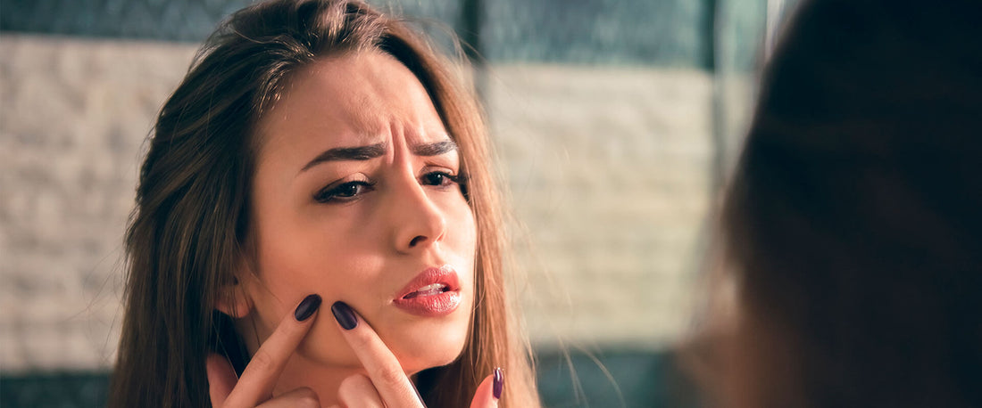 Mujer viéndose al espejo por tener problemas de acné.