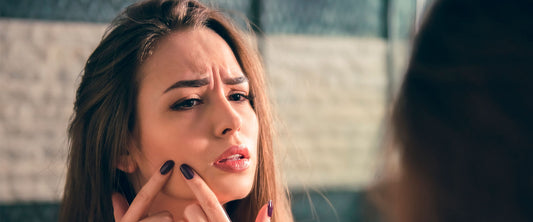 Mujer viéndose al espejo por tener problemas de acné.