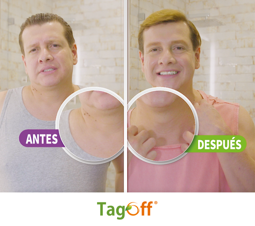 TagOff | Elimina Verrugas Naturalmente sin Dolor