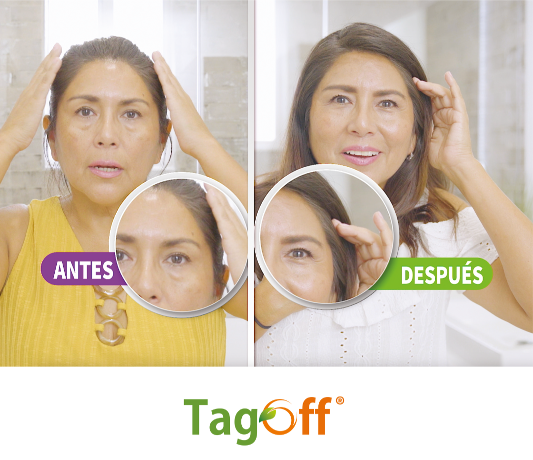 TagOff | Elimina Verrugas Naturalmente sin Dolor