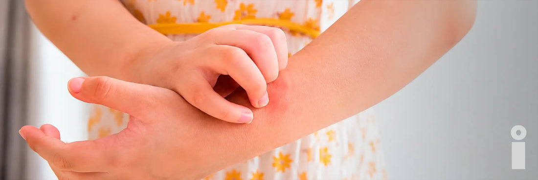 Tipos de alergias en la piel-Belleza