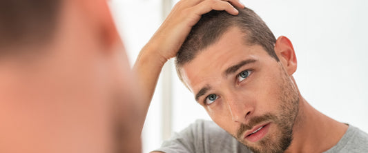Hombre con alopecia viéndose en el espejo