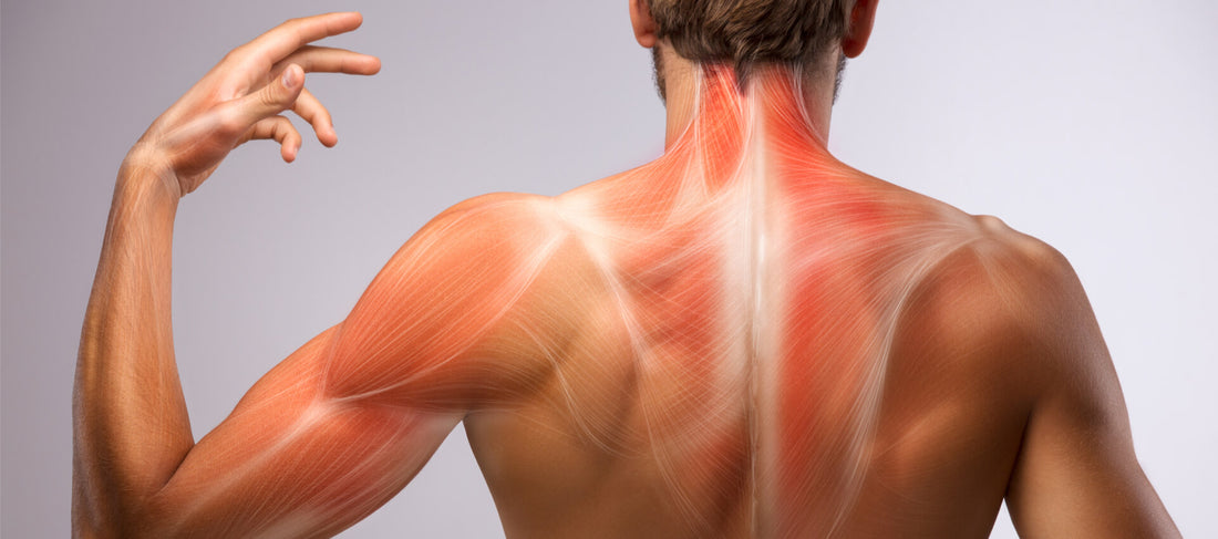 Dolor muscular