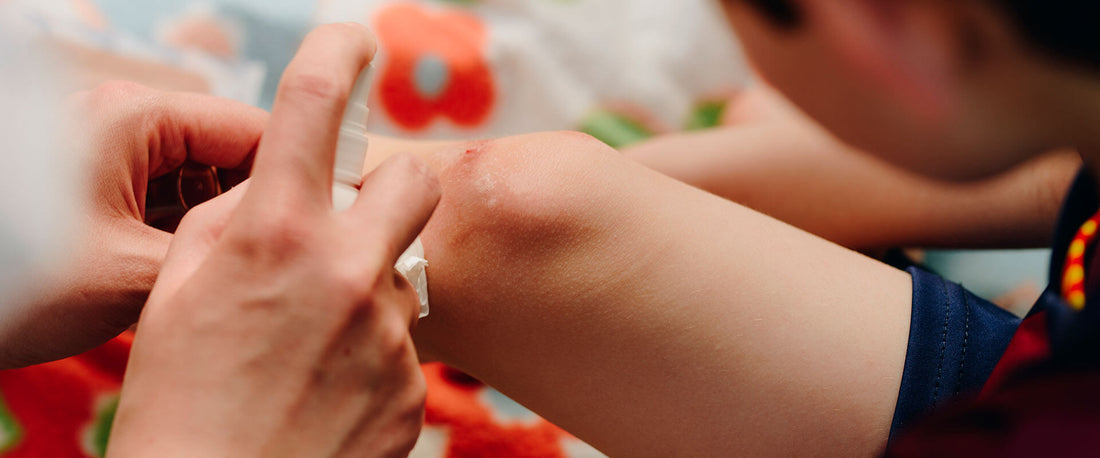 Persona curando heridas en la rodilla de un niño con Vibac30.