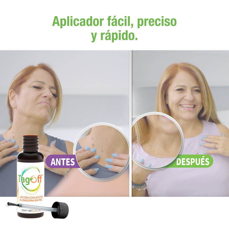 TagOff | Elimina Verrugas Naturalmente sin Dolor